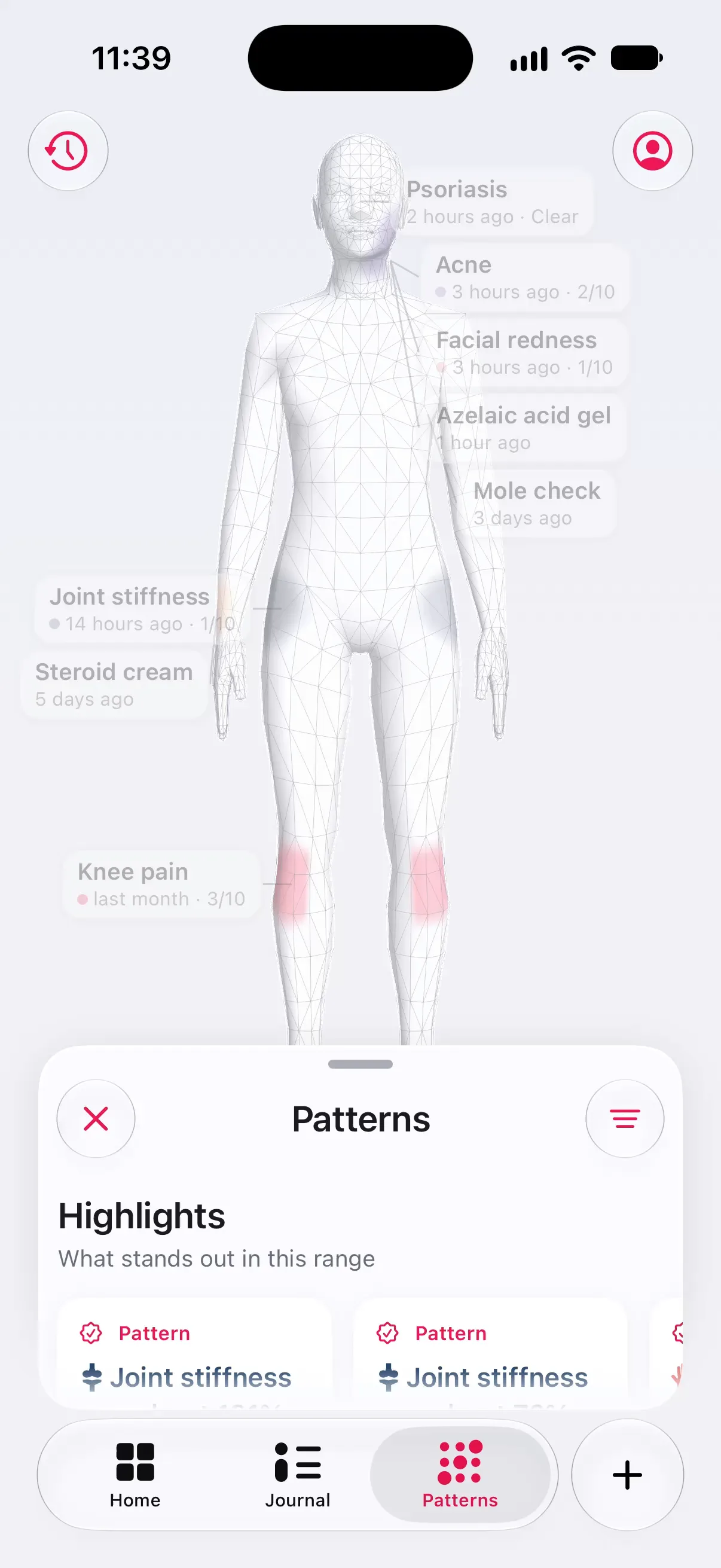 Longnote’s Patterns tab: the body with its dated callouts, dimmed behind the Highlights drawer at rest, which reads “What stands out in this range” over a row of cards, the first two graded Pattern and both about joint stiffness.